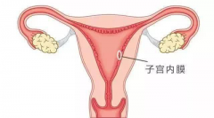 子宫内膜过薄对女性身体有什么伤害？